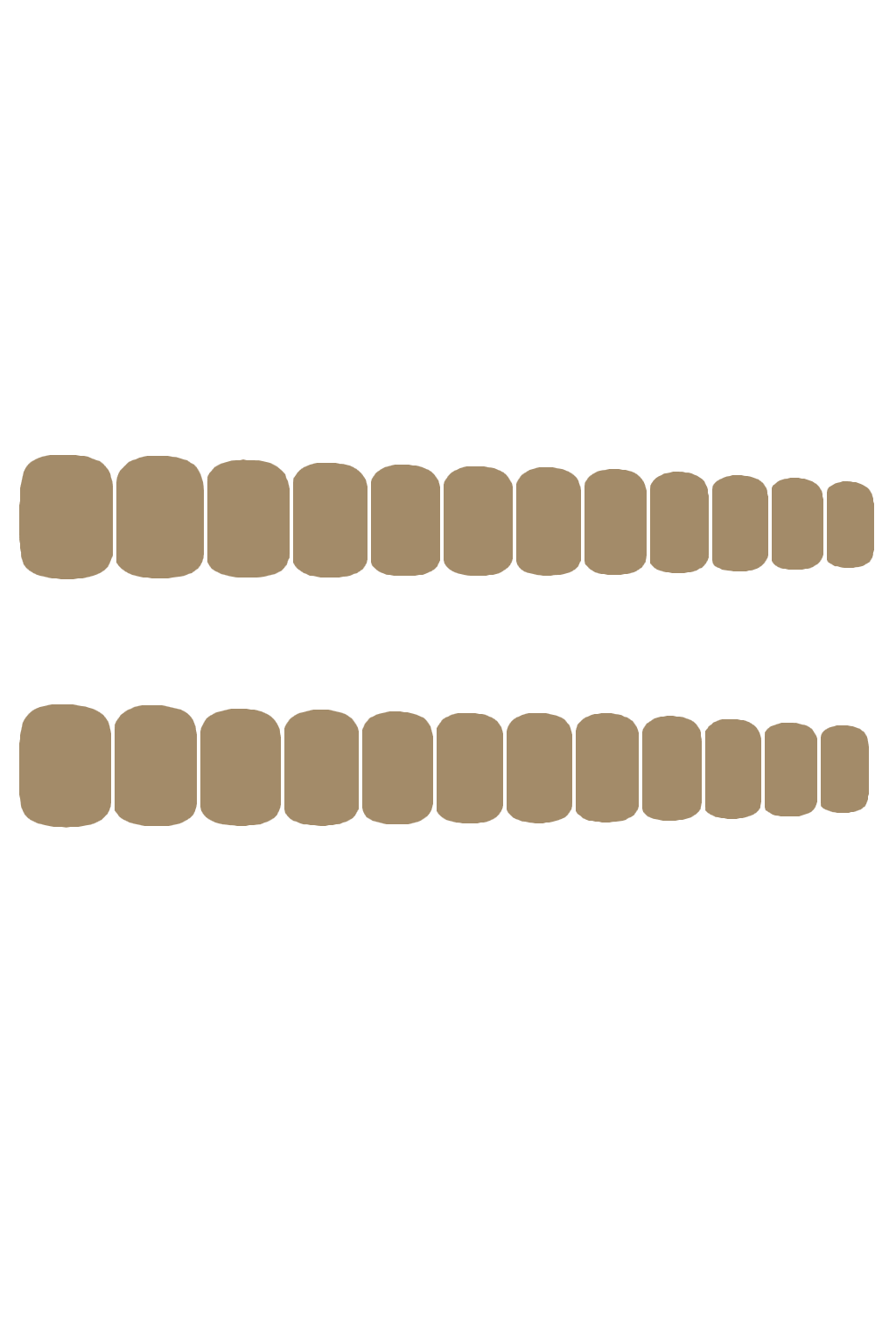 ONE-SIZE KIT