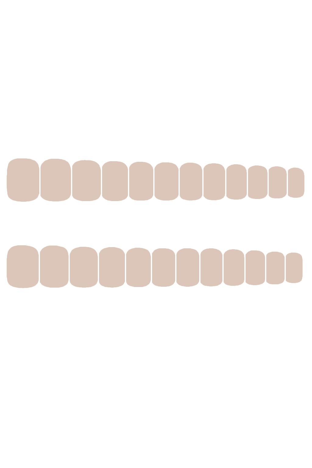 ONE-SIZE KIT